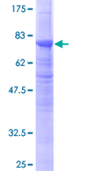 TUBB2A (Human) Recombinant Protein (P02)