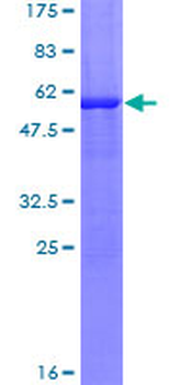 TTPA (Human) Recombinant Protein (P01)