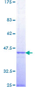 TSG101 (Human) Recombinant Protein (Q02)