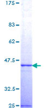 TSG101 (Human) Recombinant Protein (Q01)
