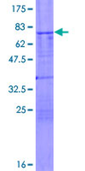 TSG101 (Human) Recombinant Protein (P01)