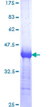 TRAF3 (Human) Recombinant Protein (Q01)