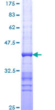 TPT1 (Human) Recombinant Protein (Q01)