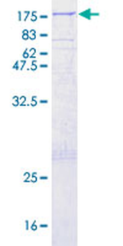 TPO (Human) Recombinant Protein (P01)
