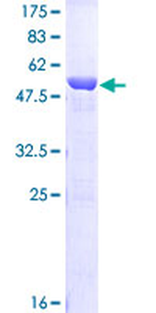 TPI1 (Human) Recombinant Protein (P01)