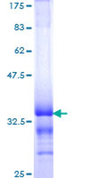 TOP1 (Human) Recombinant Protein (Q01)