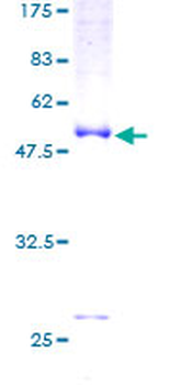 TNNI1 (Human) Recombinant Protein (P01)