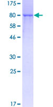 TNFRSF1B (Human) Recombinant Protein (P01)