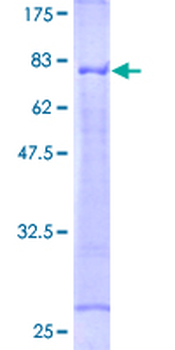 TNFRSF1A (Human) Recombinant Protein (P01)