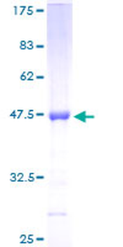 TIMP2 (Human) Recombinant Protein (P01)