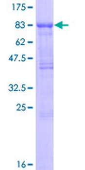 TGFBR2 (Human) Recombinant Protein (P02)