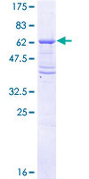 TGFBR2 (Human) Recombinant Protein (P01)