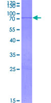 TGFB3 (Human) Recombinant Protein (P02)