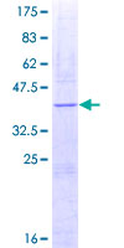 TGFB1 (Human) Recombinant Protein (Q02)