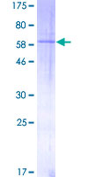 TGFB1 (Human) Recombinant Protein (P01)
