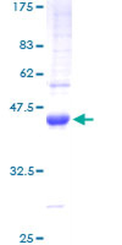 TGFA (Human) Recombinant Protein (P01)