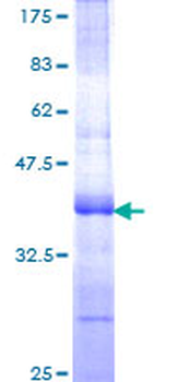 TFPI (Human) Recombinant Protein (Q01)