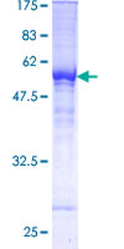 TFPI (Human) Recombinant Protein (P01)