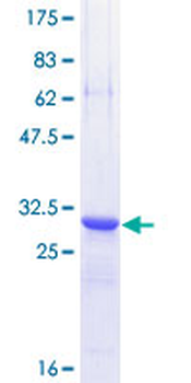 TFF3 (Human) Recombinant Protein (P01)