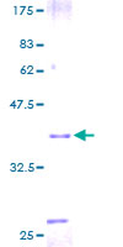 TFF2 (Human) Recombinant Protein (P01)