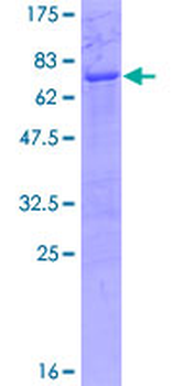 TEF (Human) Recombinant Protein (P01)