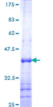 TEAD4 (Human) Recombinant Protein (Q01)