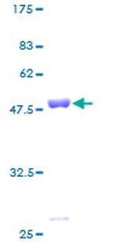 PRDX2 (Human) Recombinant Protein (P01)