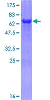 TDO2 (Human) Recombinant Protein (P01)