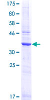 TCEB1 (Human) Recombinant Protein (P01)