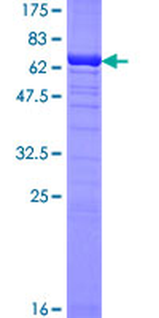 TBCC (Human) Recombinant Protein (P01)