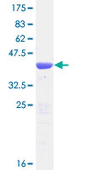 TBCA (Human) Recombinant Protein (P02)