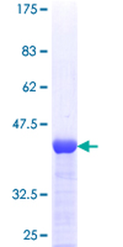 TBCA (Human) Recombinant Protein (P01)