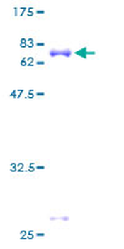 TARBP2 (Human) Recombinant Protein (P01)