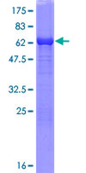 TALDO1 (Human) Recombinant Protein (P01)