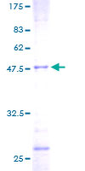 TAGLN (Human) Recombinant Protein (P01)