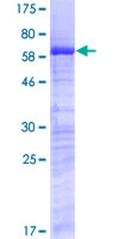 SURF2 (Human) Recombinant Protein (P01)
