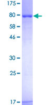 SUOX (Human) Recombinant Protein (P01)