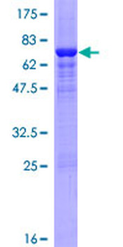 SULT2B1 (Human) Recombinant Protein (P01)