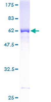 SULT1A3 (Human) Recombinant Protein (P01)