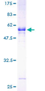 SULT1A1 (Human) Recombinant Protein (P01)