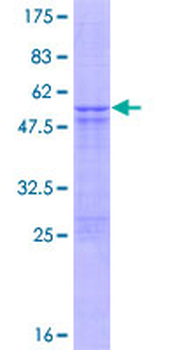 STYX (Human) Recombinant Protein (P01)