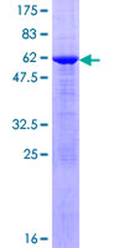 SULT1E1 (Human) Recombinant Protein (P01)