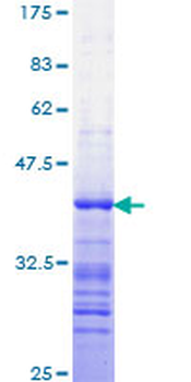 STAT3 (Human) Recombinant Protein (Q01)
