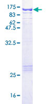 STAT1 (Human) Recombinant Protein (P01)