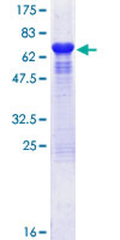ST13 (Human) Recombinant Protein (P02)