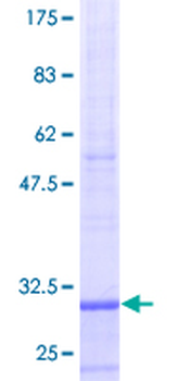 ST13 (Human) Recombinant Protein (P01)