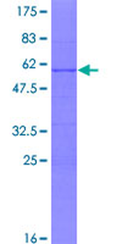 SSX1 (Human) Recombinant Protein (P01)
