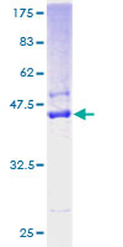 SSR4 (Human) Recombinant Protein (P01)