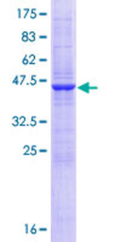 SSR2 (Human) Recombinant Protein (P01)