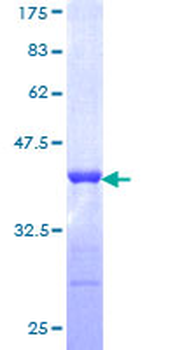 TRIM21 (Human) Recombinant Protein (Q01)
